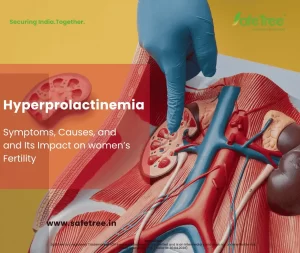 Hyperprolactinemia