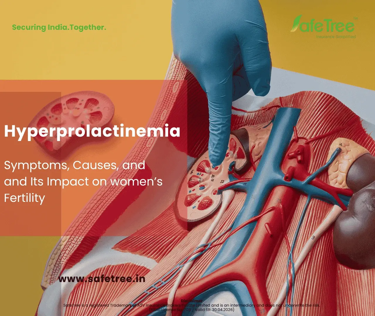 Hyperprolactinemia